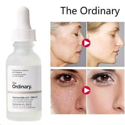 The Ordinary Niacinamide 10%+Zinc 1% Little chic